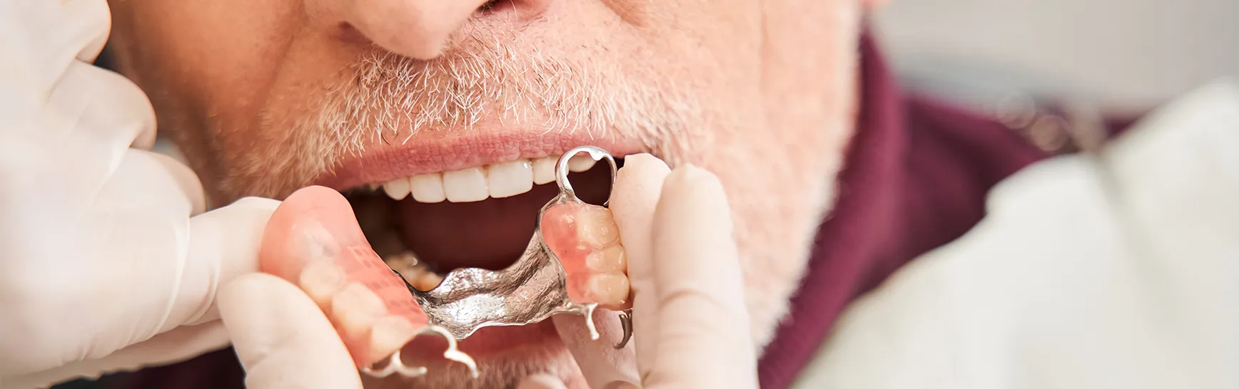 当院の入れ歯治療の特長