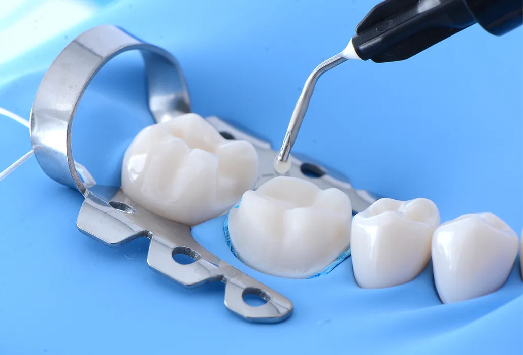 ラバーダム防湿