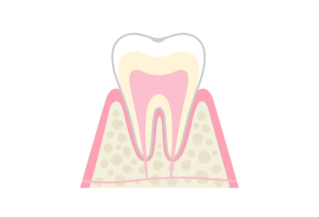 CO 脱灰(だっかい)