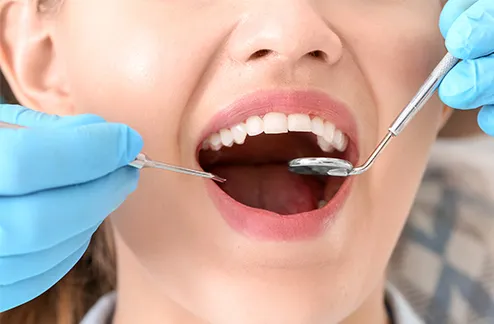 虫歯になる原因はさまざまですが、いくつかの条件が重なって虫歯になることがほとんどです。