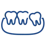 顎が痛い（噛み合わせ）