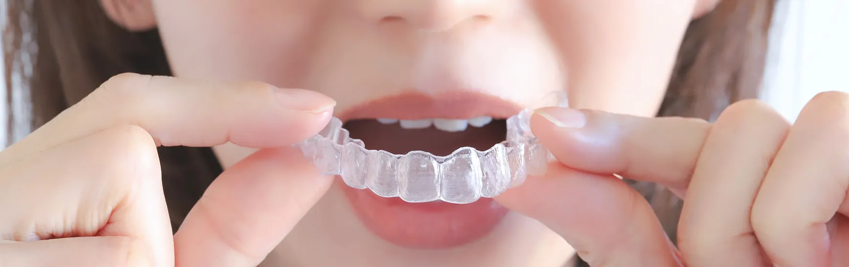 目立たず、快適に歯並びを整える「マウスピース型矯正装置」