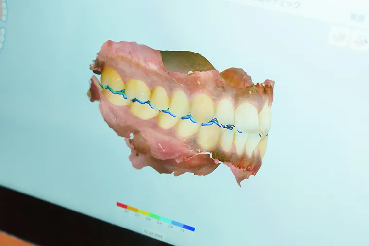 治療計画のご提案