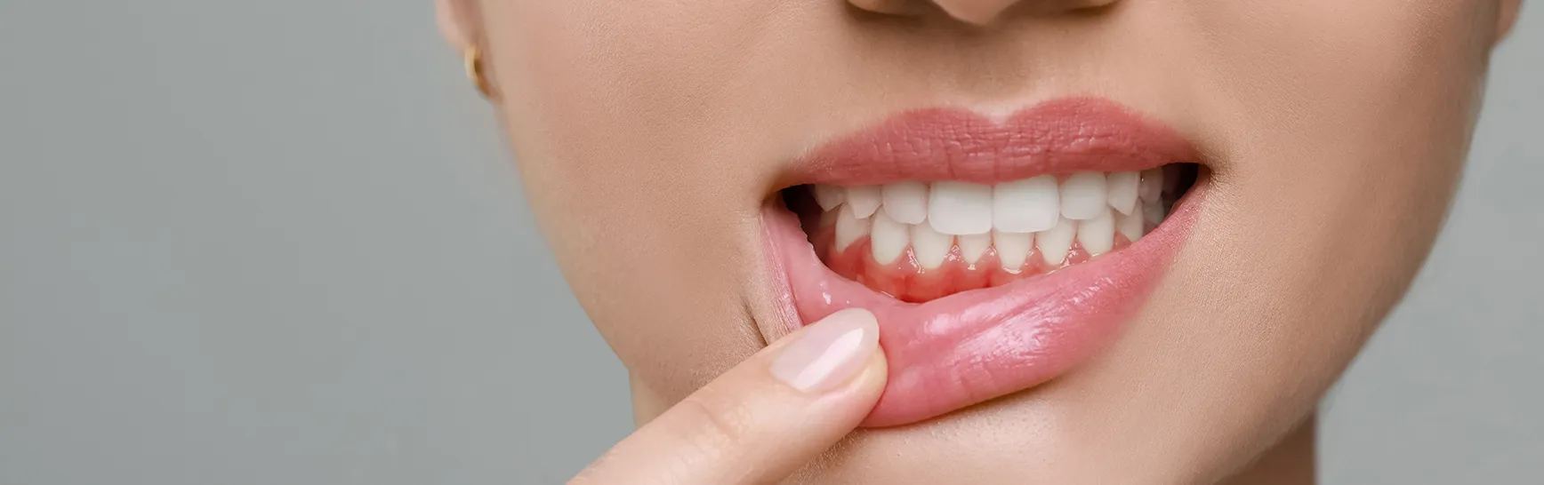 歯槽膿漏と歯周病って違うの？