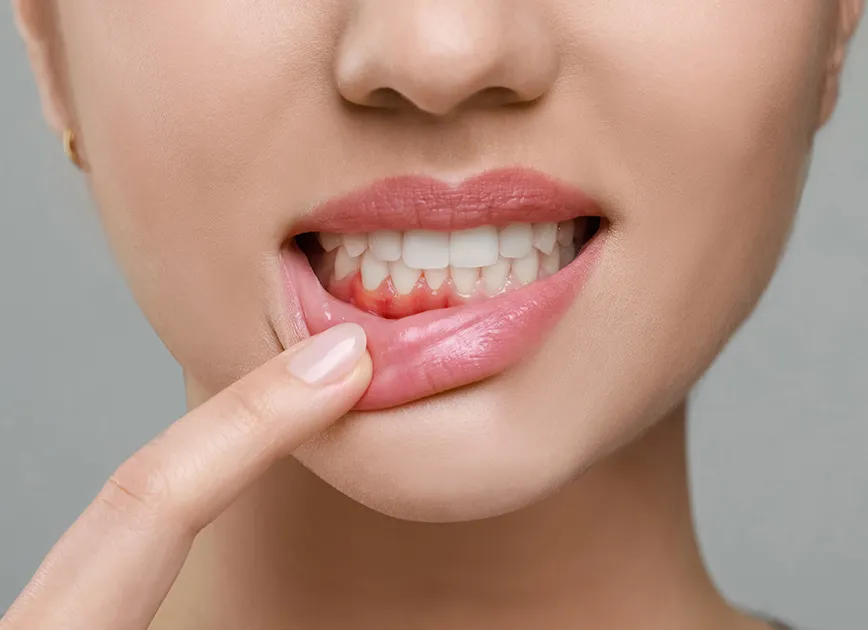 気づかぬうちに進行する「歯周病」予防には定期検診が重要です