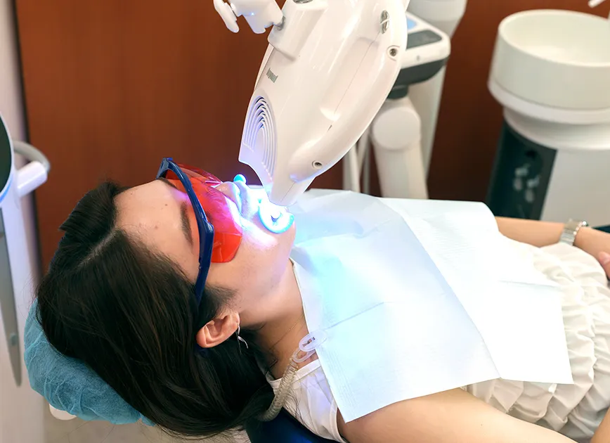 オフィスホワイトニング