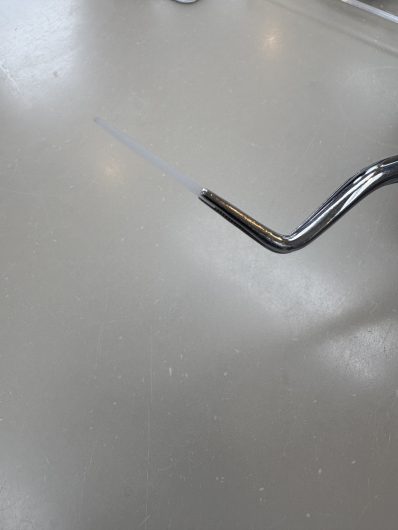 ファイバーポストによる歯根の土台補強