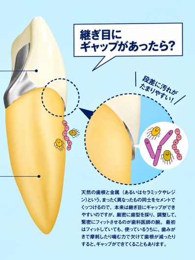 セラミック治療の本質